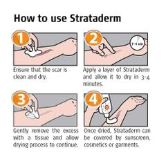 Combo Gel Silicone Strataderm & Stratamed cho vết thương hở, hỗ trợ ngăn ngừa sẹo xấu, làm mềm và phẳng vết sẹo, hiệu quả cao.