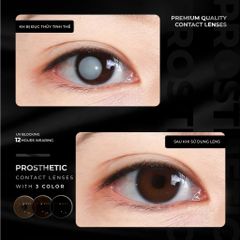 Kính áp tròng thẩm mỹ Angel Eyes - Lens che khuyết điểm cho mắt bị đục thủy tinh thể, cườm, thiết kế thời trang Hàn Quốc