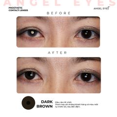 Kính áp tròng thẩm mỹ Angel Eyes - Lens che khuyết điểm cho mắt bị đục thủy tinh thể, cườm, thiết kế thời trang Hàn Quốc