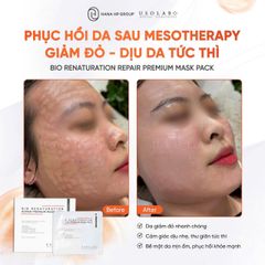 Mặt Nạ Phục Hồi Sau Xâm Lấn Usolab Bio Renaturation Repair - Gói 10 Miếng Cho Da Sáng Khỏe, Giảm Viêm, Cấp Ẩm
