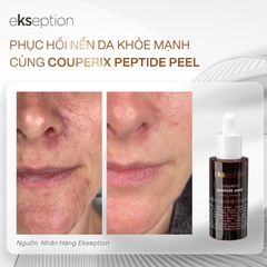 Tinh Chất Tẩy Da Chết Ekseption Couperix Peptide Peel 70ml - Dưỡng Da, Làm Sạch Tế Bào Chết, Phục Hồi Da Tươi Sáng, trẻ Hóa
