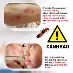 Chai Xịt Đuổi Kiến The Loco 280ml - Giải Pháp Đuổi Côn Trùng Tự Nhiên An Toàn, Đuổi Kiến, Gián, Muỗi Hiệu Quả