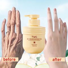 Kem Dưỡng Da Tay Gardenia Vitamin E 300g - Dưỡng Ẩm, Sáng Da, Chống Khô Nứt Nẻ Tay Chân Chính Hãng