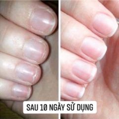 Combo 5 Hũ Dưỡng Móng Collagen Nhanh Dài, Cứng và Bóng Khỏe - Phục Hồi Móng Yếu, Dùng Cho Tiệm Nail và Cá Nhân