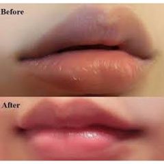 Dưỡng Môi Collagen Thiên Di - Khử Thâm & Làm Hồng Môi Tự Nhiên, Mềm Mịn, Không Hương Liệu, Dinh Dưỡng Từ Tinh Dầu Thiên Nhiên
