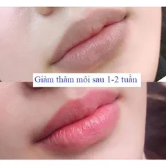 Kem Dưỡng Môi Collagen Hồng Tự Nhiên - Xóa Thâm, Giúp Môi Luôn Hồng Hào, Mềm Mịn, Chống Nắng, Duy Trì Làn Môi Khỏe Mạnh