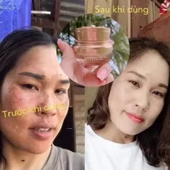 Kem Nám Tàn Nhang Saffron Hải Âu Việt - Chống Nám, Mờ Thâm, Dưỡng Trắng Da, Chiết Xuất Tự Nhiên 15gr