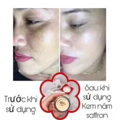 Kem Nám Tàn Nhang Saffron Hải Âu Việt - Chống Nám, Mờ Thâm, Dưỡng Trắng Da, Chiết Xuất Tự Nhiên 15gr