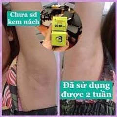 Combo 2 Lọ Kem Khử Thâm Nách & Hôi Nách Cô Bơ - Giúp Da Sáng Mịn, Giảm Mồ Hôi, Tự Nhiên, 8g
