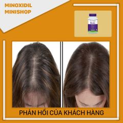 Viên Uống Biotin Natrol 100 Viên - Hỗ Trợ Tóc Khỏe Đẹp, Ngăn Rụng Tóc, Giúp Tóc Dày, Dài và Chắc Khỏe