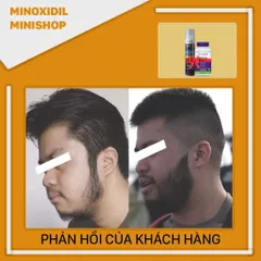 Mino 5% Foam Mọc Râu Tóc với Biotin B7 10,000mcg - Sản phẩm chăm sóc râu và tóc hiệu quả từ Mỹ