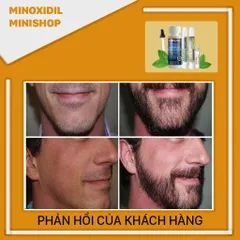 Combo Mọc Râu Tóc Nhanh Minoxidil 5% Dạng Lỏng + LCLT + Retinol + Peo 1,2ml - Bộ Chăm Sóc Da Mặt Mỹ Phẩm Chất Lượng