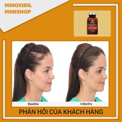 Advanced Trichology DHT Blocker Chống DHT - Mọc tóc - Giảm nhờn da đầu