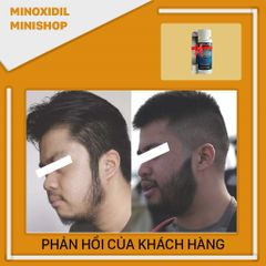 Dung dịch Minoxidil 5% Dạng Lỏng Kích Thích Mọc Râu Tóc Nhanh - Hỗ Trợ Phát Triển Lông Mày, Sản Phẩm Mỹ Kirkland