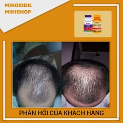 Viên Uống Biotin & Folic Mason - Hỗ Trợ Mọc Râu Tóc, Dưỡng Chất Tóc Chắc Khỏe, Ngăn Gãy Rụng, 100 Viên