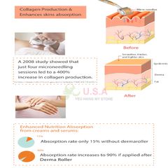 Lăn Kim ZGTS 192 Micro Needles Derma Roller 0.5mm - Giải Pháp Chăm Sóc Da Hiệu Quả Tại Nhà, Stimulator Collagen và Tăng Cường Hấp Thụ Dưỡng Chất