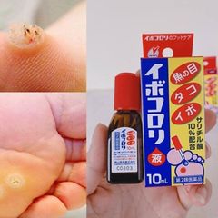Dung dịch giúp bong rụng mụn cóc Ibokorori Nhật Bản 10ml