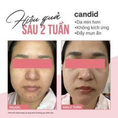 Tinh Chất Dưỡng Da Candid Retinol 0.5% Retinol/ 1% Retinol 30ml