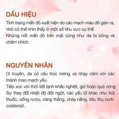 Hoạt Chất Innoaesthetics INNO-TDS REDNESS ID Cho Da Nhạy Cảm, Da Giãn Mao Mạch, Mẩn Đỏ
