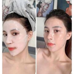 Mặt Nạ Derm All Matrix [ Miếng Lẻ ] Hàn Quốc Cao Cấp Dưỡng Trắng, Căng Bóng Da ( 1 Hộp = 4 miếng )
