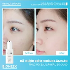 Tinh chất Tranexide Biomeek Serum hỗ trợ dưỡng sáng, mờ thâm 30ml