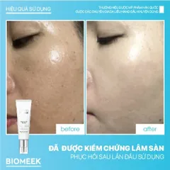 Kem dưỡng Tranexide Biomeek Cream dưỡng sáng, mờ thâm 50ml