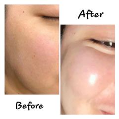 Kem Dưỡng Chống Lão Hoá Làn Da Obagi Retinol 0.5 Và Retinol 1.0