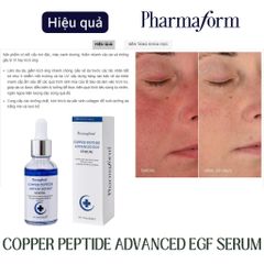 Serum Phục hồi chống lão hóa  Pharmarorm Copper Peptide Advance Serum with 1% GHK-Cu & 100ppm EGF 30 ml