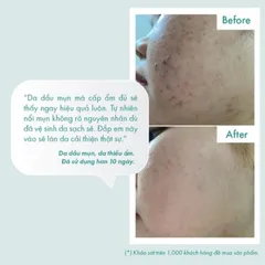 Combo 10 Mặt Nạ Dưỡng Ẩm B5 OMUSE Aquaporin Mask [ Nhập Khẩu Chính Hãng ]