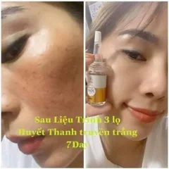Huyết thanh truyền trắng 7day Olic/Serum 7day Olic trắng da mờ nám dưỡng ẩm Chính Hãng
