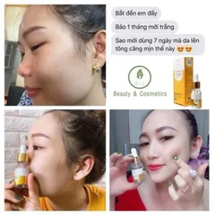 Huyết thanh truyền trắng 7day Olic/Serum 7day Olic trắng da mờ nám dưỡng ẩm Chính Hãng