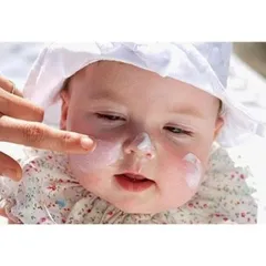 Kem Dưỡng Da Chống Nẻ Pháp Dexeryl Crème 250g Chính Hãng - Nẻ Chàm Glycerol Vaseline Paraffine Creme