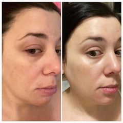 Serum PIGM 400 BR Biologique Recherche 30ml Giảm Nám Và Làm Sáng Da [ Chính Hãng ]