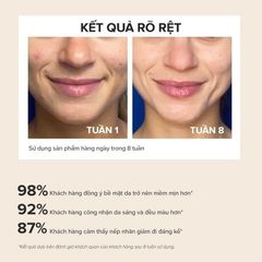 Gel Tẩy Da Chết Paula's Choice Skin Perfecting 8% AHA Gel Exfoliant 100ml