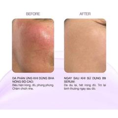Serum B9 Vic Derma Folic Acid Phục Hồi Trẻ Hóa Vicderma 50ML