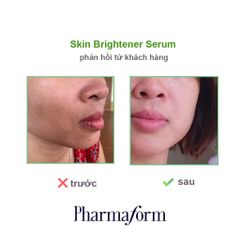 Serum Làm sáng da, cải thiện thâm nám PHARMAFORM Skin Brightener Serum 20ml