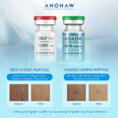 Tế Bào Gốc Phục Hồi Da Ahohwa  SRGF H1 Reset Ampoule 10000PPM  - Kích Thích Tế Bào Mới, Trẻ Hoá Làn Da