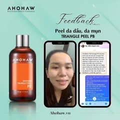 Dung Dịch Ahohwa Triangle Peel Pb Peel Dành Cho Da Dầu 80ml