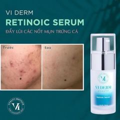 Vi Derm Beauty Retinoic Serum RX Tinh Chất Trẻ Hóa Da, Giảm Mụn 30ml Viderm