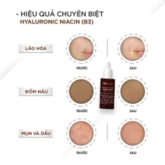 Serum Ekseption Hyaluronic Niacin HA + 5% B3 sáng da, mờ thâm mụn