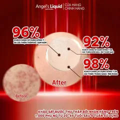 Siêu Tinh Chất Xoá Thâm Đỏ Mờ Sạm Nám Angel's Liquid Tranexamic Mela Ampoule 30ml [ Chính Hãng ]