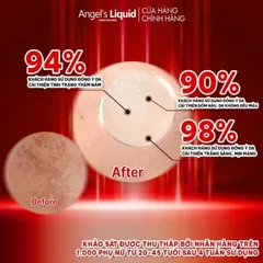 Kem Dưỡng Tranexamic Acid Mờ Nám Chuyên Sâu Angel's Liquid Mela Cream 50ml