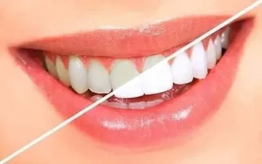 Kem Đánh Răng ODOL Med 3 - Công Thức 3 Trong 1 Ngừa Sâu Mịn Răng, Bảo Vệ Nướu, Hơi Thở Thơm Mát - Hàng Nhập Khẩu UK