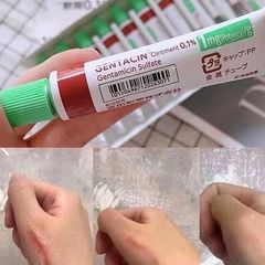 Kem dưỡng mờ sẹo Gentacin Nhật Bản 10g