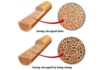 Viên uống Canxi Kirkland 600mg + D3 hộp 500 viên - Tăng cường sức khỏe xương khớp, hỗ trợ hấp thụ canxi từ Mỹ