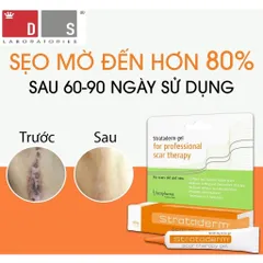Gel Xóa Sẹo Strataderm 10g - Điều Trị Sẹo Lồi, Sẹo Rỗ, Sẹo Thâm Nhập Khẩu Thụy Sĩ - Giải Pháp Tốt Nhất Cho Làn Da Bạn