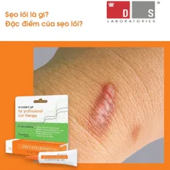 Gel Xóa Sẹo Strataderm 10g - Điều Trị Sẹo Lồi, Sẹo Rỗ, Sẹo Thâm Nhập Khẩu Thụy Sĩ - Giải Pháp Tốt Nhất Cho Làn Da Bạn
