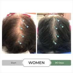 Serum Tăng Mọc Tóc Spectral.CBD 60ml - Giảm Rụng, Gàu & Kích Thích Mọc Tóc Dày Đầy, Công Nghệ Nanosome Mỹ