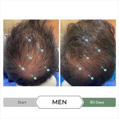 Combo Dầu Gội Xả Revita.CBD & NIA - Kích Thích Mọc Tóc, Ngăn Ngừa Gãy Rụng, Dưỡng Tóc Khỏe Mạnh - Chăm Sóc Tóc Hư Tổn