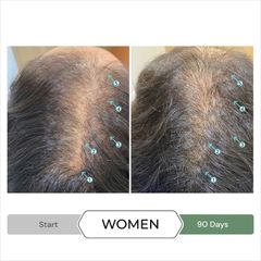 Combo Dầu Gội Xả Revita.CBD & NIA - Kích Thích Mọc Tóc, Ngăn Ngừa Gãy Rụng, Dưỡng Tóc Khỏe Mạnh - Chăm Sóc Tóc Hư Tổn